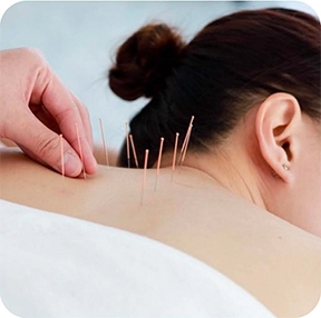 Pre-Kinetic Wellness Centre - Acupuncture in Maple Ridge & Pitt Meadows